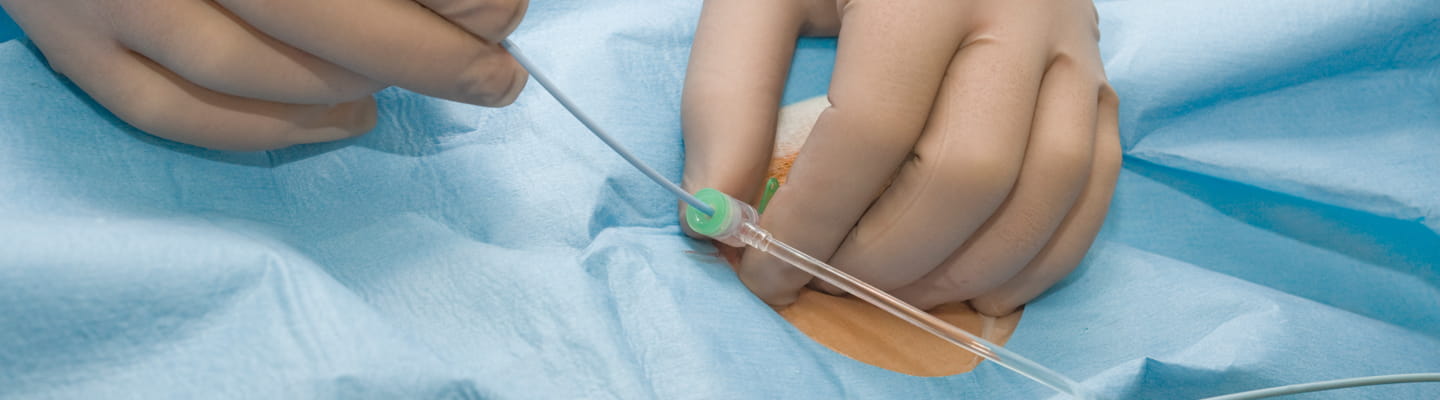 Cardiac Catheter-Based Procedures | Houston Methodist