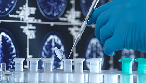 close up of doctor with blue gloves using a pipette