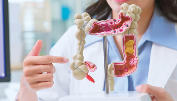 4 Colon Cancer Symptoms to Never Ignore