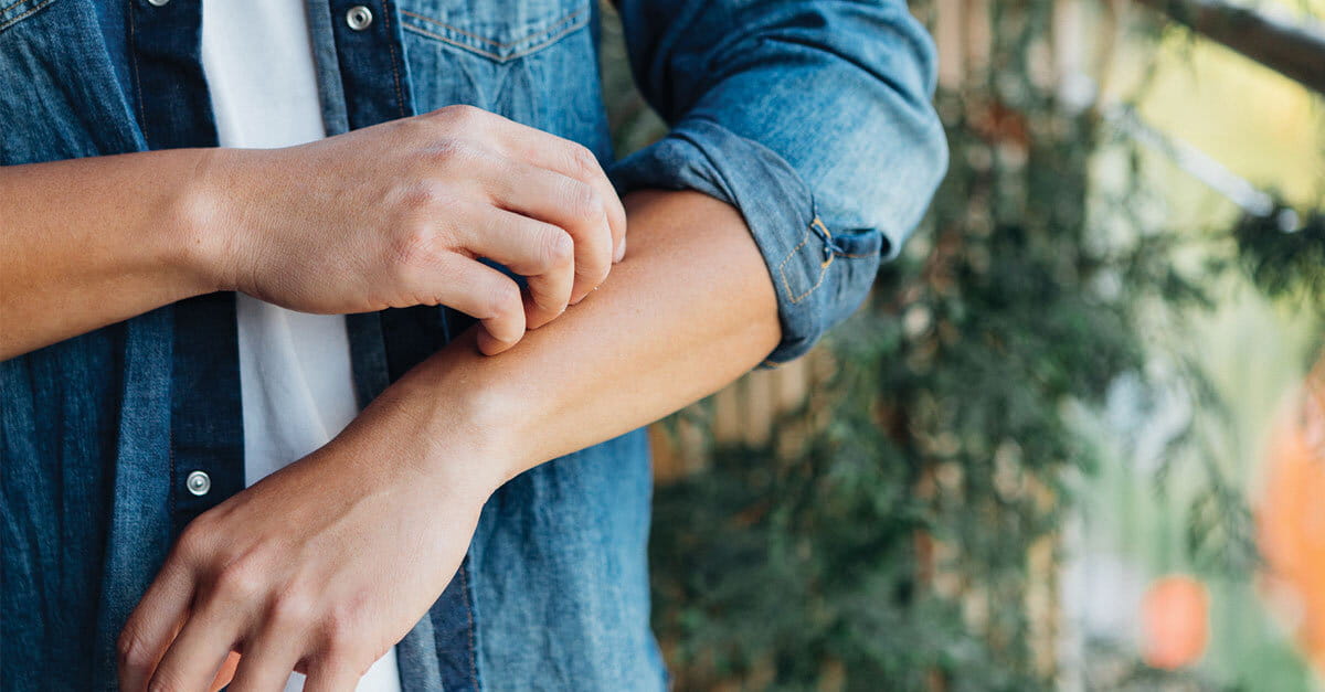 Sensitive Skin Symptoms, Common Triggers & How It's Treated Houston