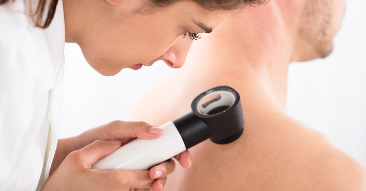 Skin Tag vs. Mole How Can You Tell the Difference? Houston Methodist