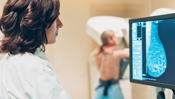 mammogram image