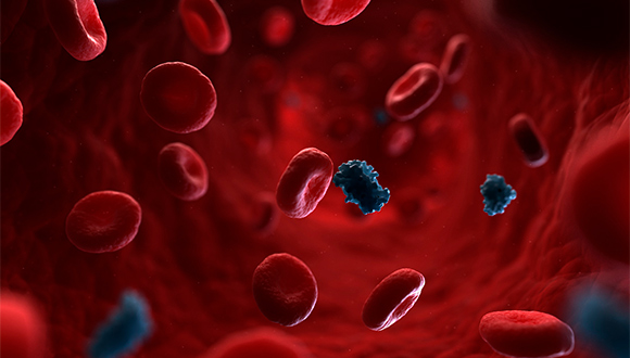 what is metabolic syndrome and can it be reversed?