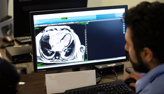 A man reviewing an image on a computer screen of a cardiac MRI