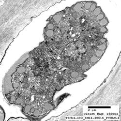 EM of Acanthamoeba cyst