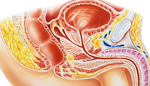 Urinary Incontinence