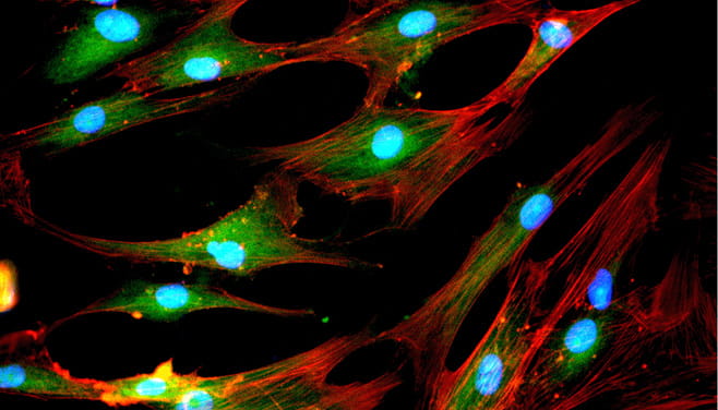 Bioinformatics infrastructure for gene sequencing