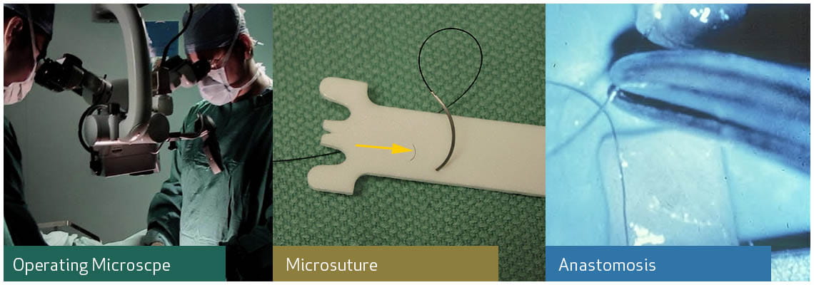 operating microscope banner