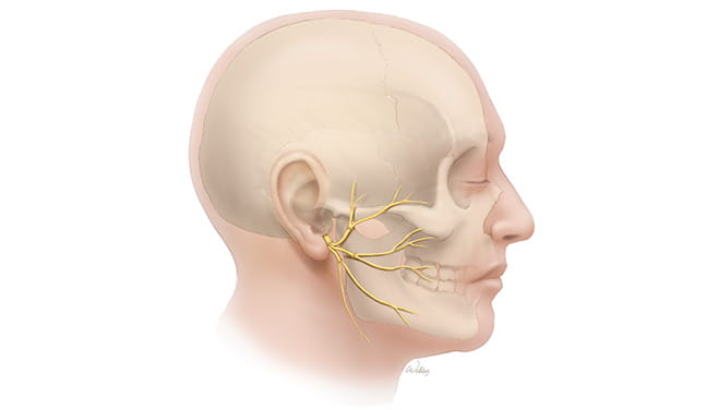 Reconstruction with Nerve Grafts