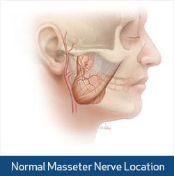 normal masseter nerve illustration