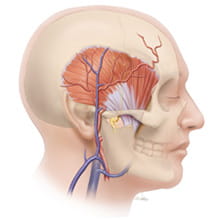 temporalis illustration