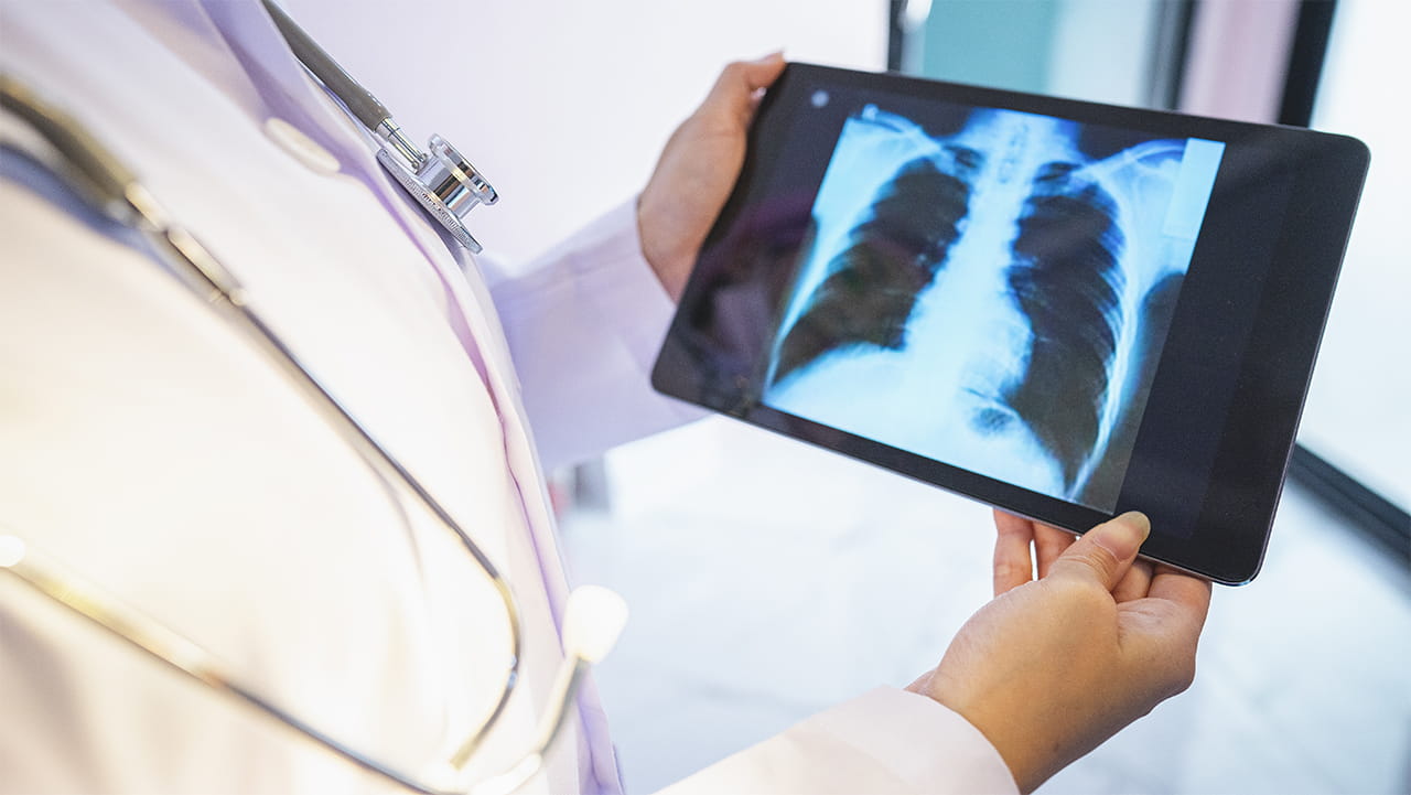 Doctor holds a device showing an x-ray of a two lungs.