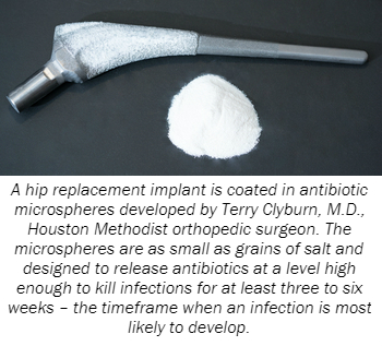 A hip replacement implant is coated in antibiotic microspheres developed by Terry Clyburn, M.D., Houston Methodist orthopedic surgeon. The microspheres are as small as grains of salt and designed to release antibiotics at a level high enough to kill infections for at least three to six weeks – the timeframe when an infection is most likely to develop.