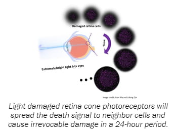 Light damaged retina cone photoreceptors will spread the death signal to neighbor cells and cause irrevocable damage in a 24-hour period.