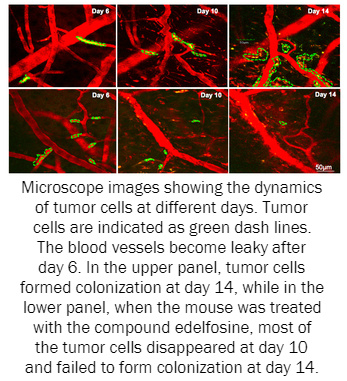 Microscope images showing the dynamics of tumor cells at different days. Tumor cells are indicated as green dash lines. The blood vessels become leaky after day 6. In the upper panel, tumor cells formed colonization at day 14, while in the lower panel, when the mouse was treated with the compound edelfosine, most of the tumor cells disappeared at day 10 and failed to form colonization at day 14. 