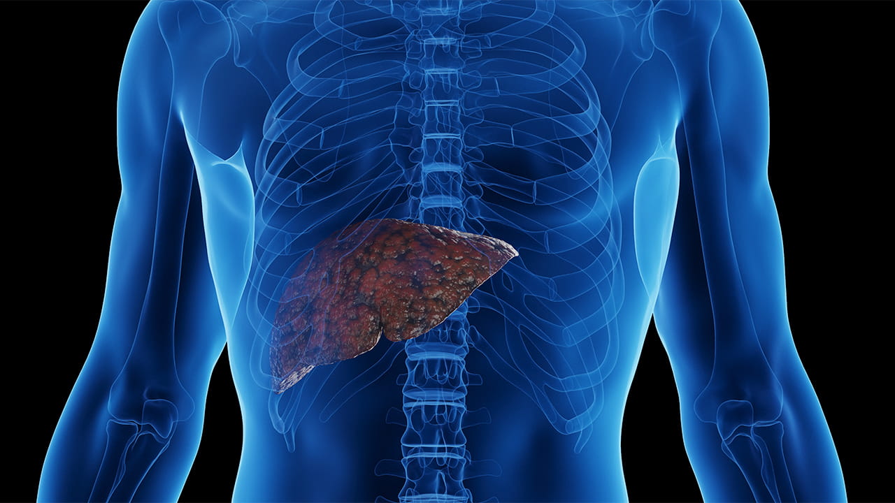 Study Challenges Seven-Day Hold on GLP-1 Agonists Before Surgery