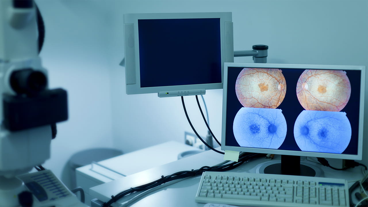 Image shows a clinical desk with a computer and other equipment on it. Results of an optical coherence tomography exam show on the computer monitor.