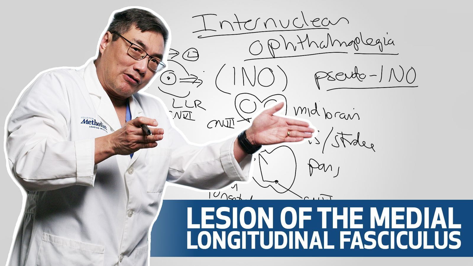 Pons Ino WATCH: Whiteboard Video on Internuclear Ophthalmoplegia Breaks Down ...
