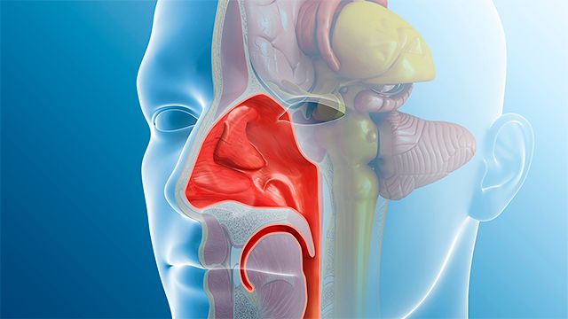 A graphic rendering shows the sinus cavities underneath a transparent male skull/face.