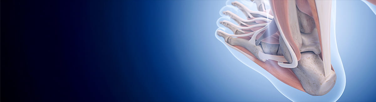 Houston Methodist Leads Phase 2 Clinical Trial for Achilles Tendinopathy
