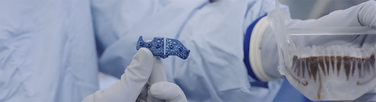 Close-up of a gloved hand holding a small blue 3D-printed medical implant with a lattice design, while another gloved hand holds a clear container with biological material in a clinical or laboratory setting.