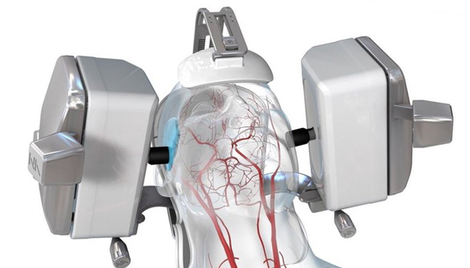 image of Lucid™ M1 Transcranial Doppler Ultrasound System®