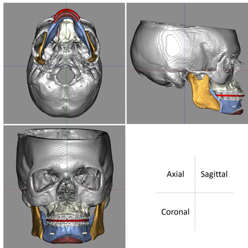 computer images of skulls 