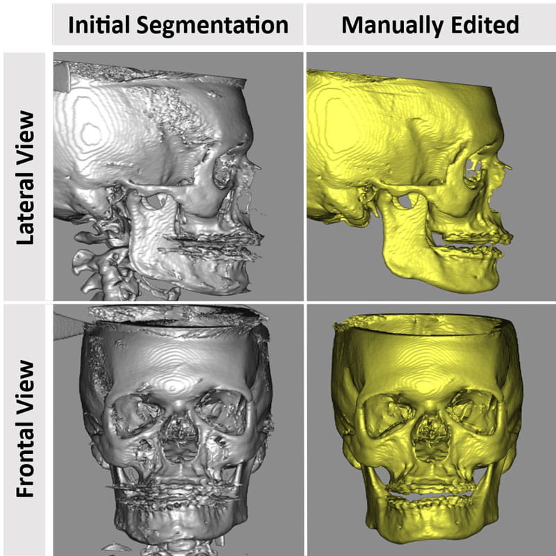 skull imaging