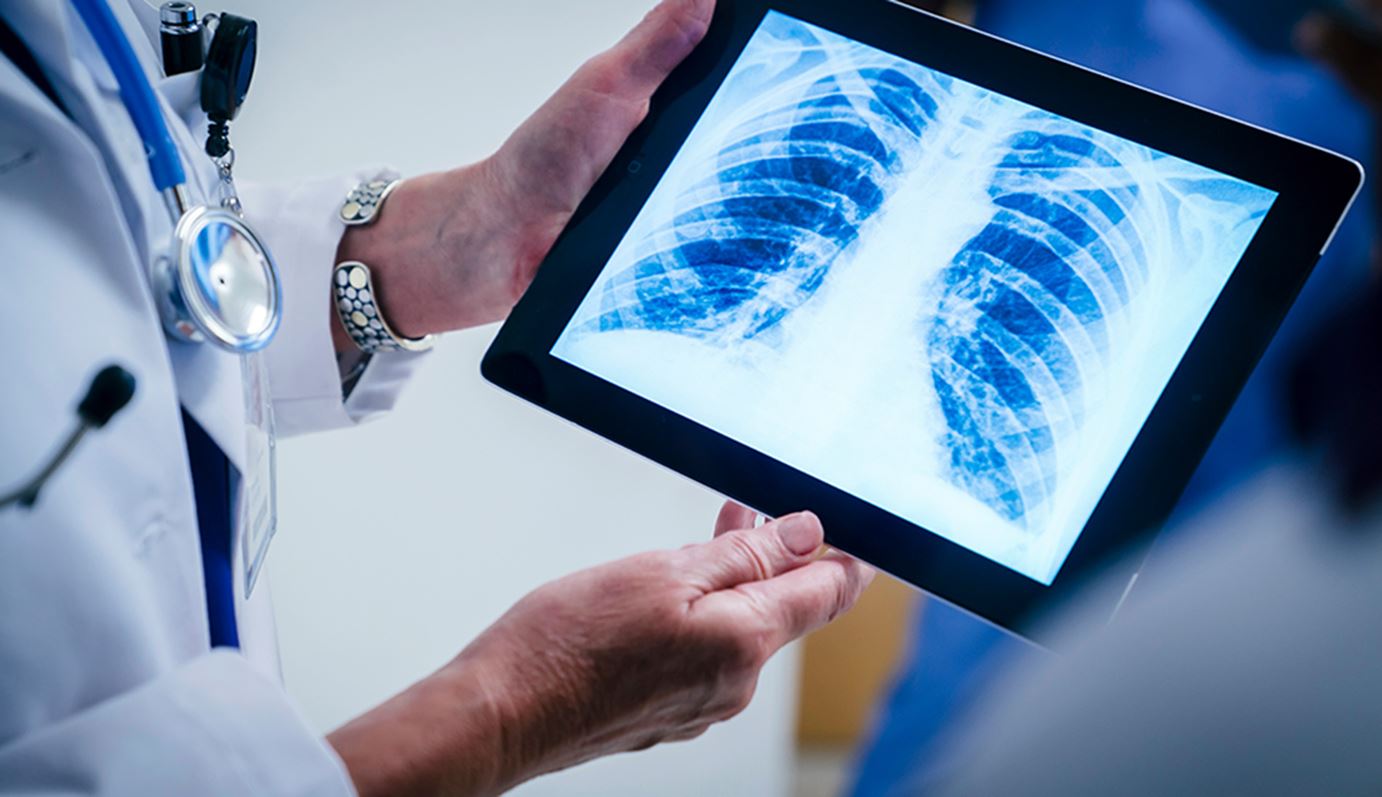 Doctor looking at chest x-rays