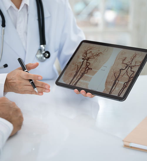 Healthcare provider showing blood vessel imaging on a tablet and discussing stroke treatment options with a patient during a medical consultation.