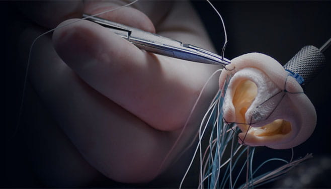 A Clinic Dedicated to Treating Valve Disease