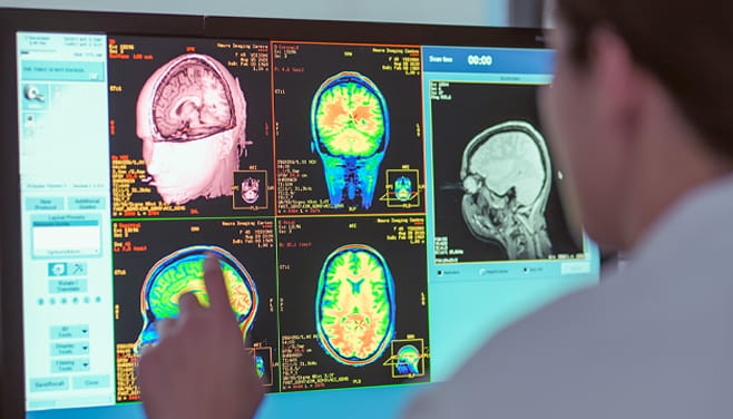 doctor looking at multiple multicolored brain scans on a computer screen