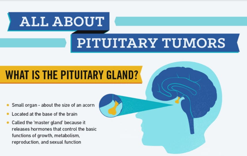 All About Pituitary Tumors