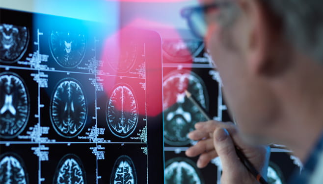 doctor examining multiple digital brain scans