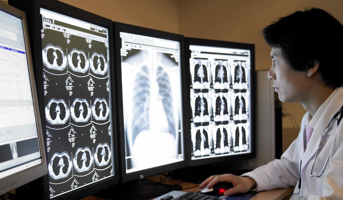 doctor looking at lung x-rays