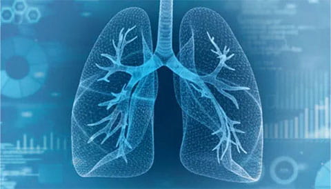 lung screening 