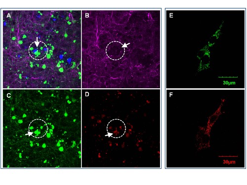 In the brain of mice with Alzheimer’s, areas near amyloid plaques (A) appear with fewer neural networks (B), dying neurons (C) and higher OCIAD1 (D). In cultured neuronal cells, the OCIAD1 proteins (E) appear in the mitochondria (F).